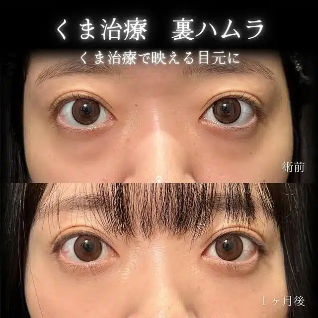 裏ハムラ　新宿