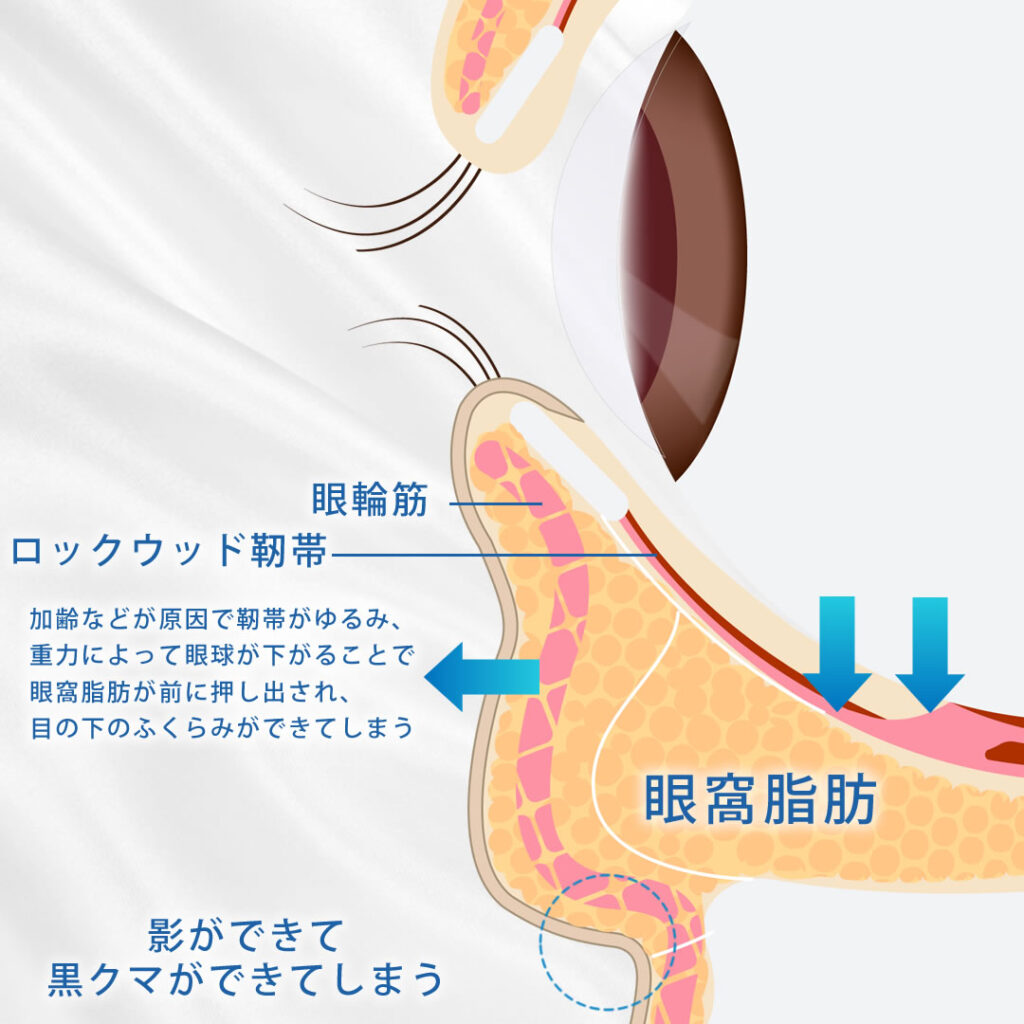 ロックウッド靭帯の図解