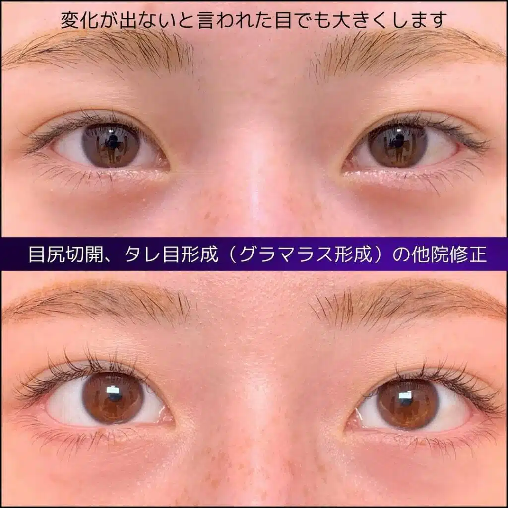 グラマラスライン形成　新宿