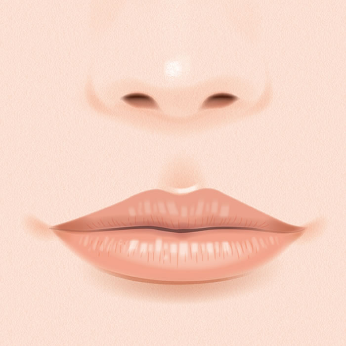 口唇縮小術のイメージ