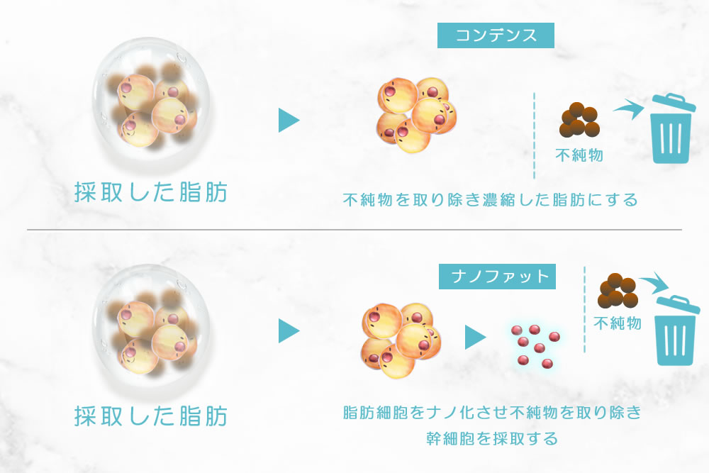 コンデンスファットとナノファットの違いの図解