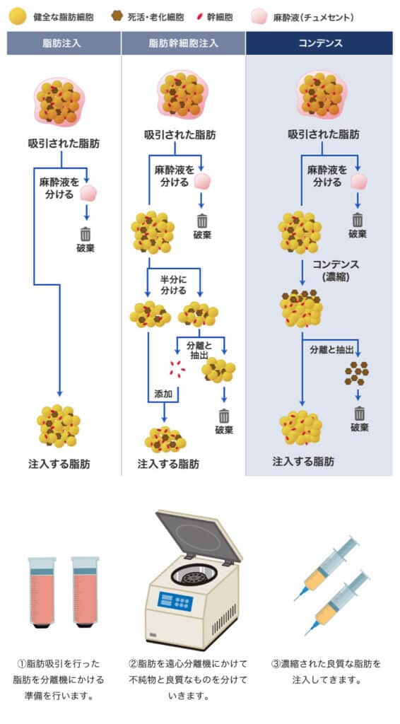 脂肪細胞をコンデンスする図解