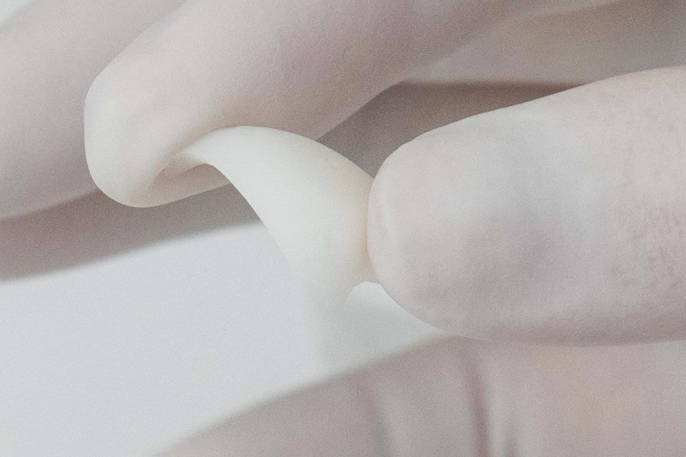 貴族手術で使用するプロテーゼ