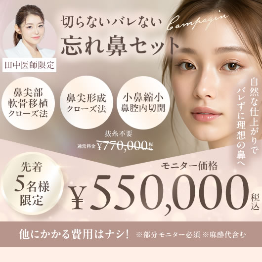 忘れ鼻のバナー