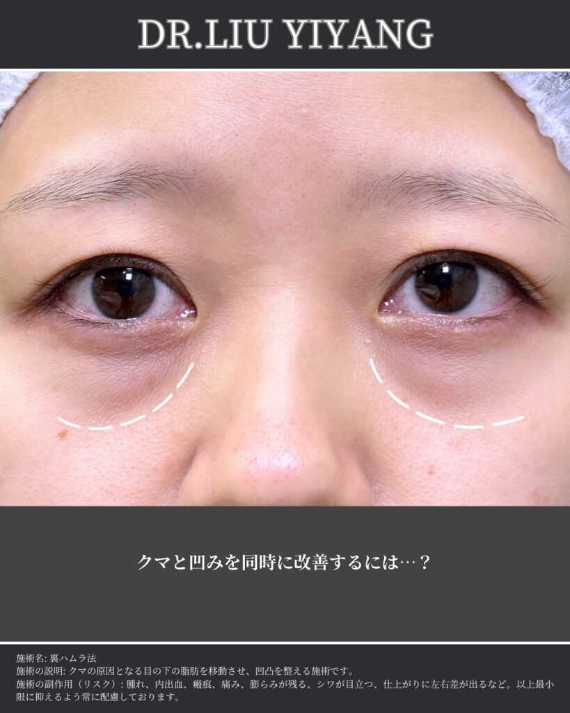 裏ハムラとナノリッチの症例写真 (11)