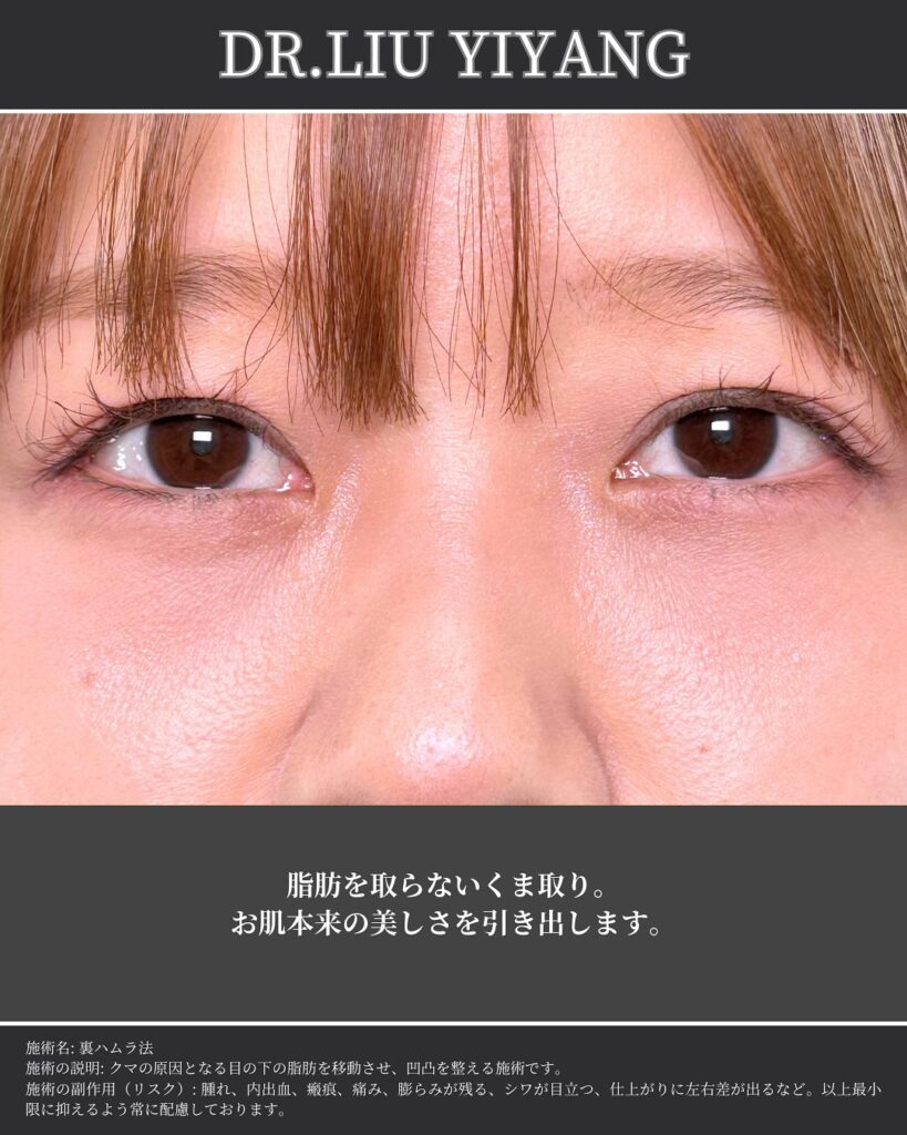 裏ハムラとナノリッチの症例写真 (10)