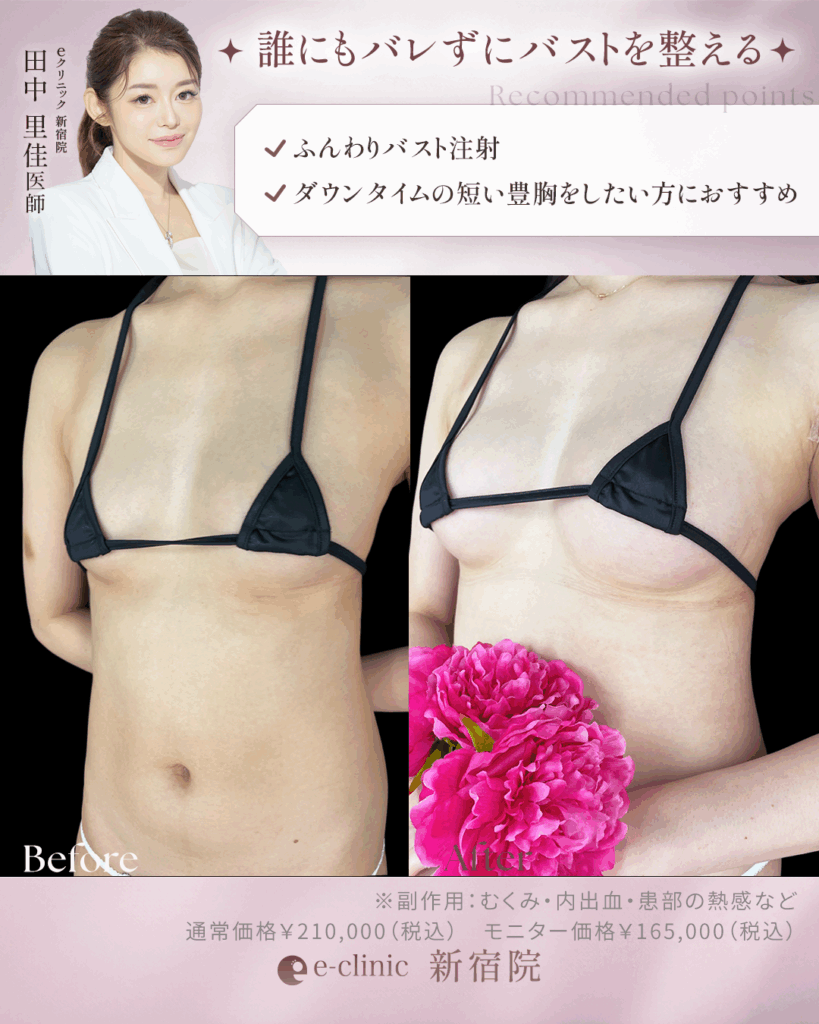 ふんわりバスト症例