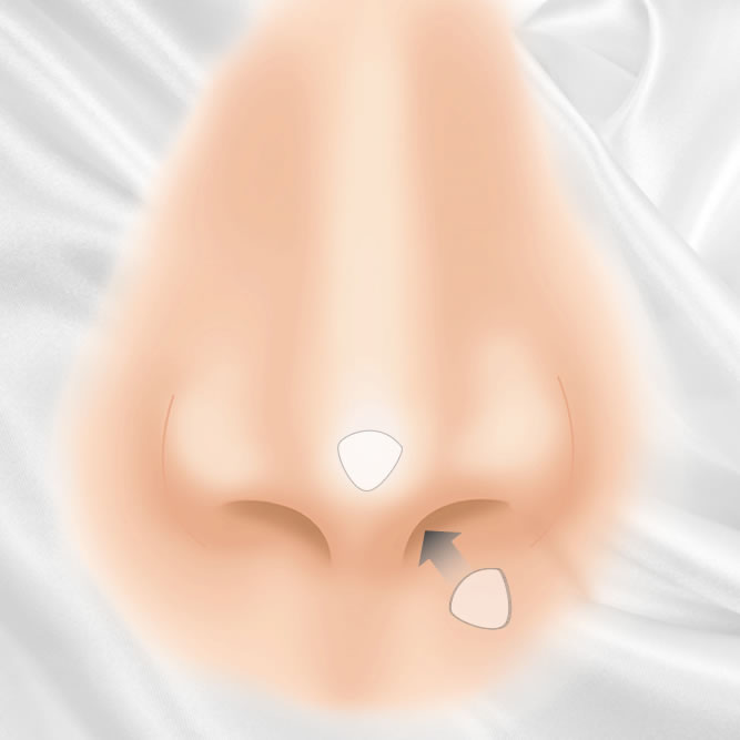 鼻尖部人工真皮のイメージ