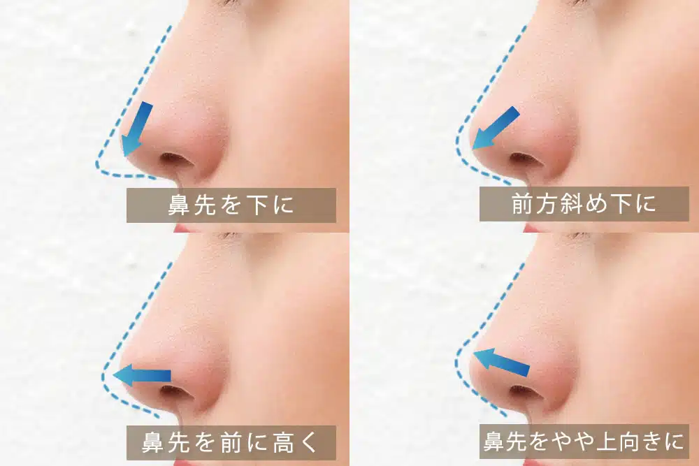 耳軟骨を鼻に挿入するデザイン 新宿