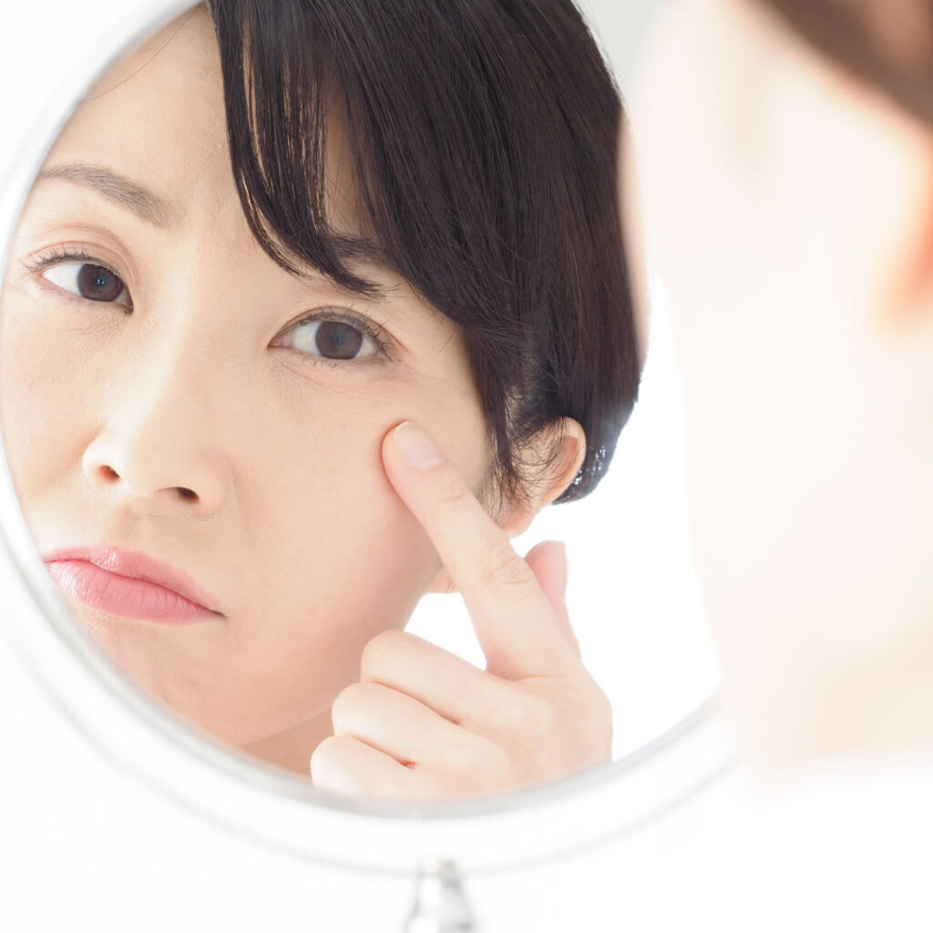 目尻のしわが気になる女性