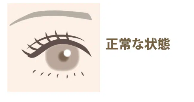 正常な目　新宿