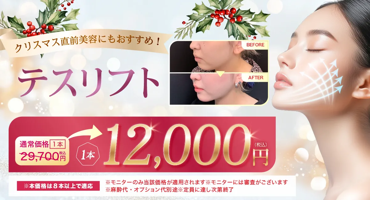 閑散期糸リフト