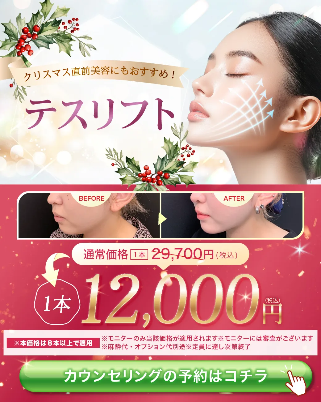 閑散期糸リフト