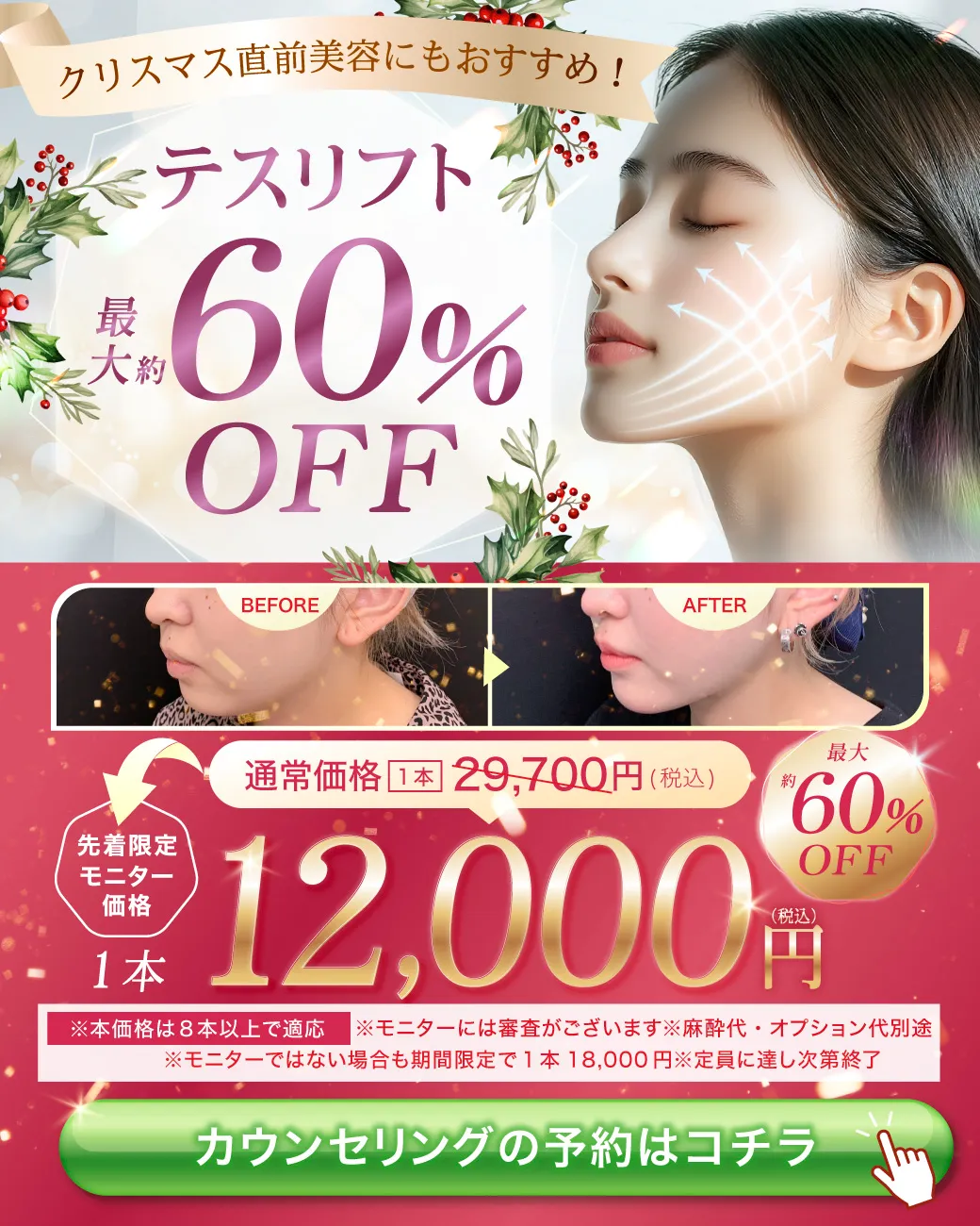 閑散期糸リフト