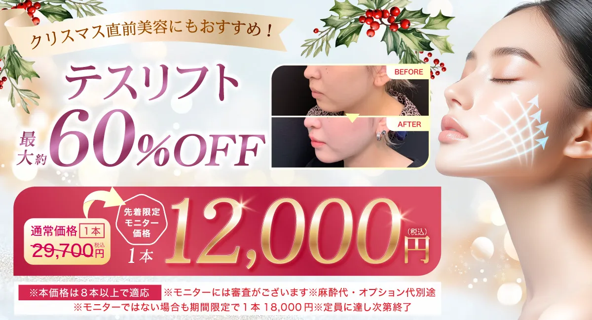 閑散期糸リフト