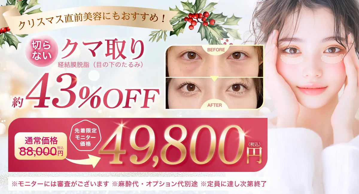 閑散期クマ取り