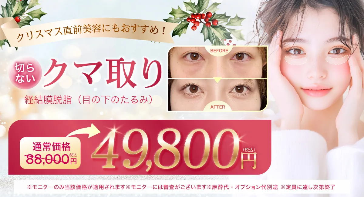 閑散期クマ取り