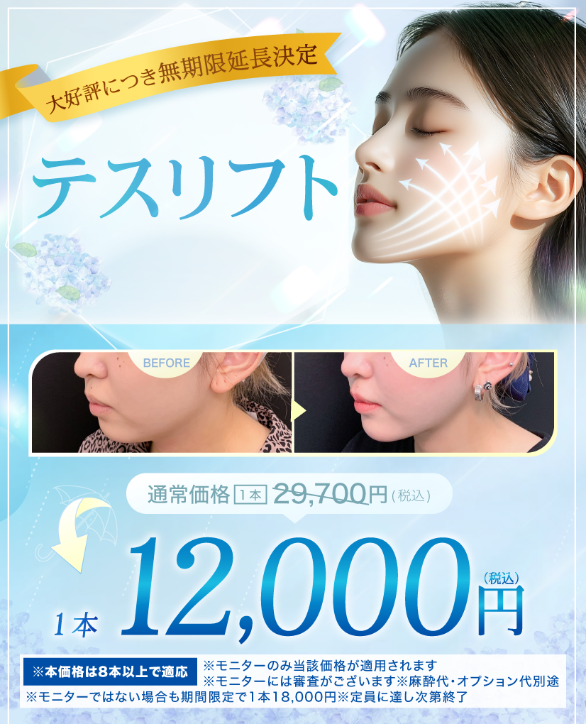 閑散期糸リフト