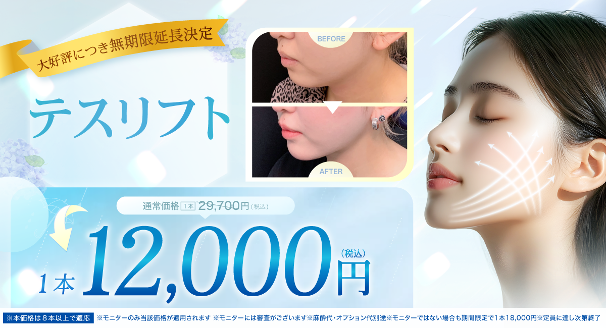 閑散期糸リフト