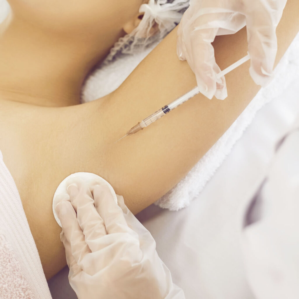 脇のボトックス注射をしているところ