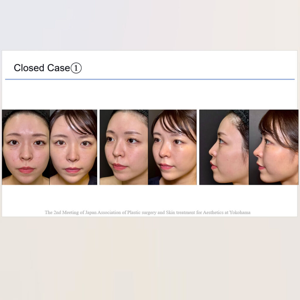 学会発表のスライド