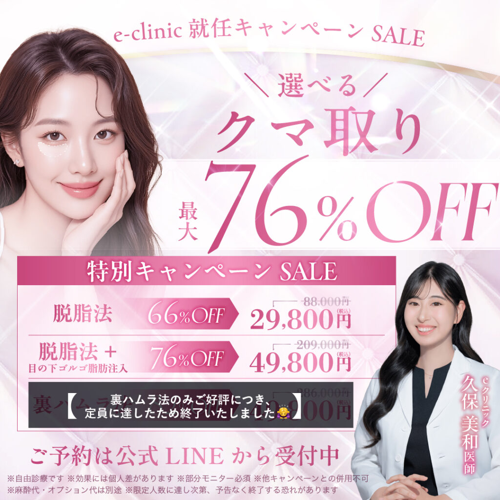 経結膜脱脂のキャンペーンバナー