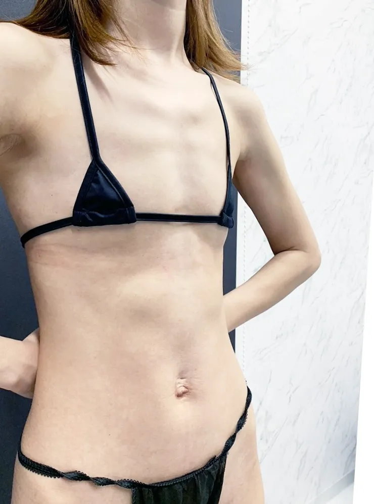 豊胸_ピュアグラフト1＋コンデンス2術前横（名医の田中里佳医師が執刀）（35）