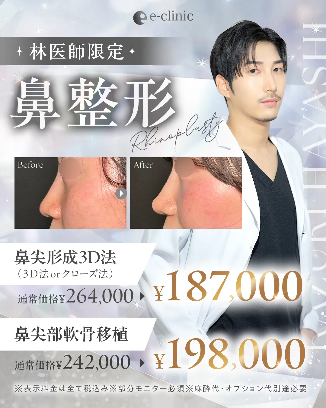 新宿院の鼻尖形成のバナー