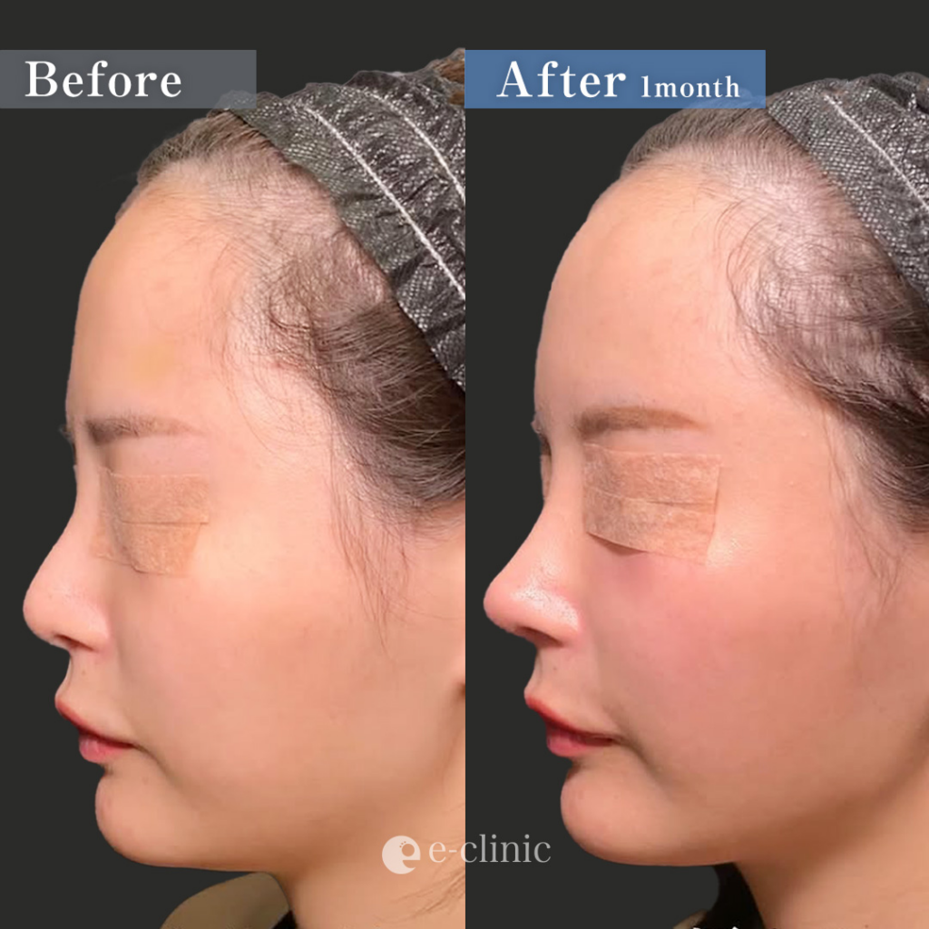 顔フル（円戸望）（24）