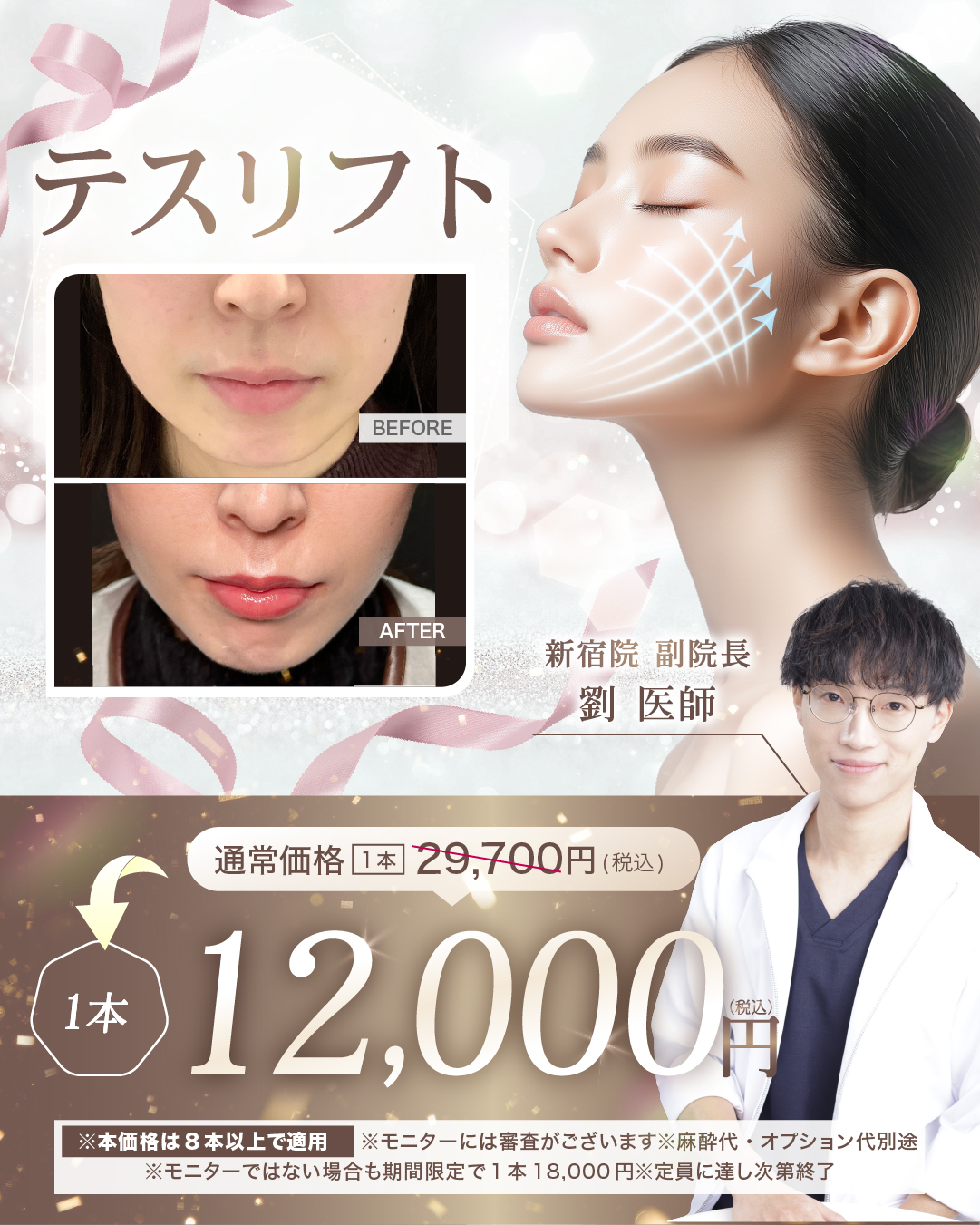 閑散期糸リフト