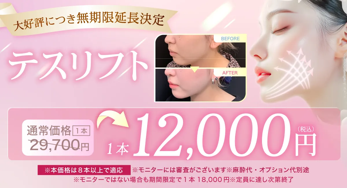 閑散期糸リフト