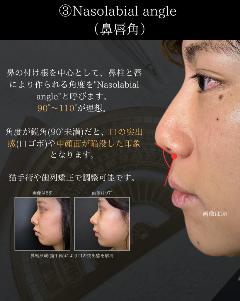 鼻の美学の説明 (4)