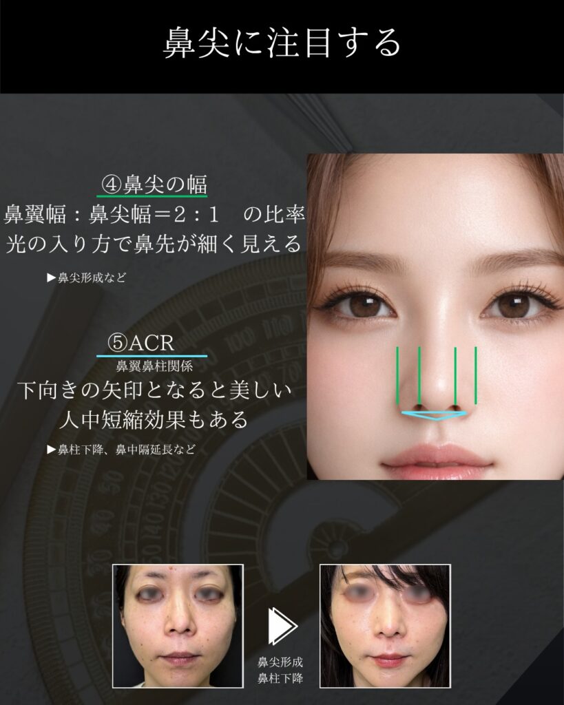 鼻整形美学の説明 (2)