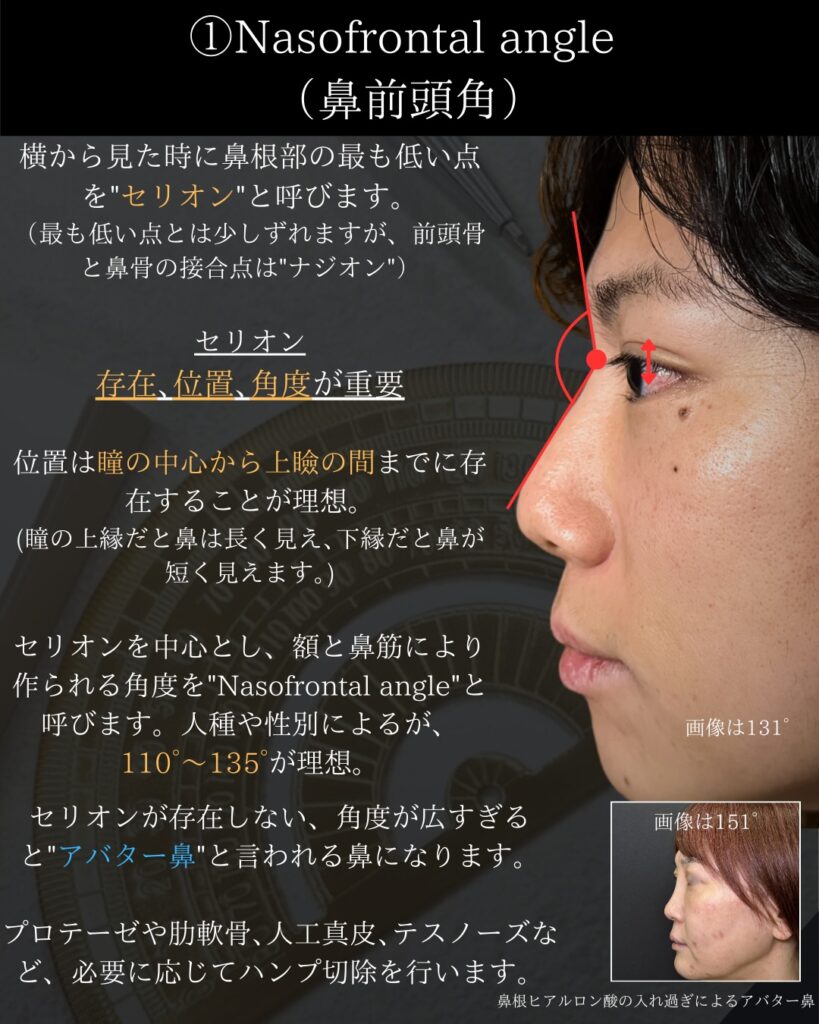 鼻の美学の説明 (1)