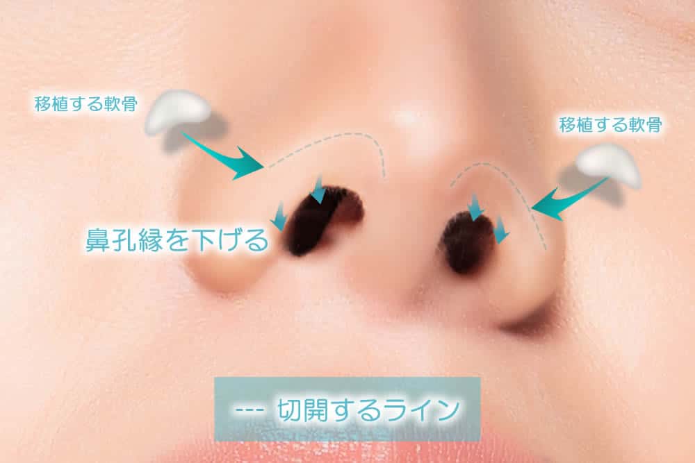 鼻の穴を下げるイメージ
